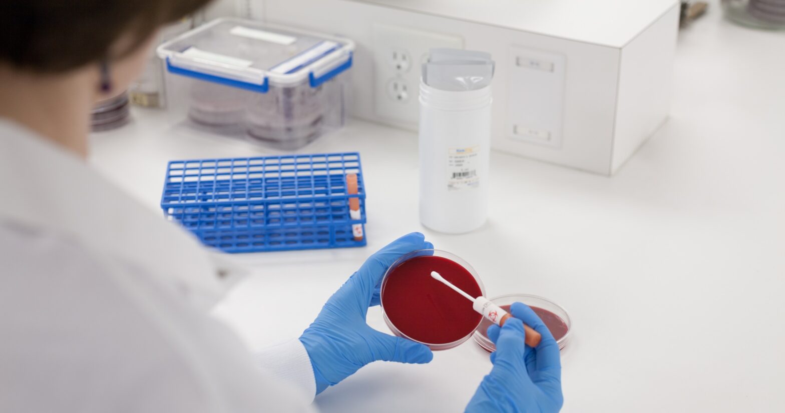 Microbiologics QC KWIK-STIK in Use
