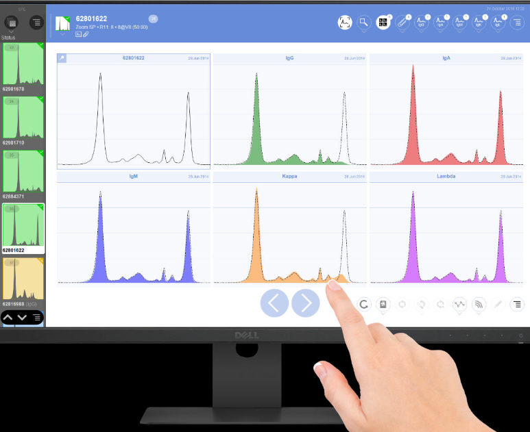 Capillary Electrophoresis Software